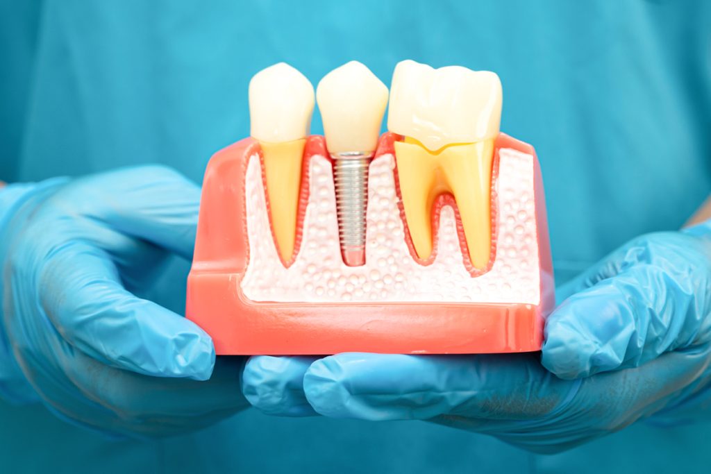 Chirurgie și implantologie